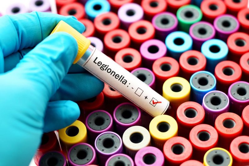 Legionella.jpg